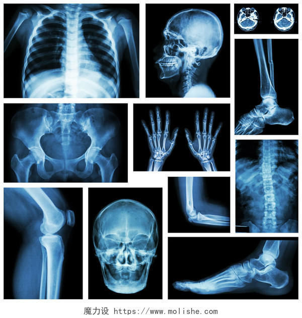 设置 x 射线的多个部分的人骨骼系统